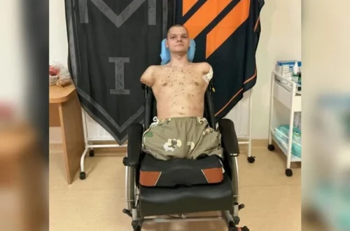 Приватбанк відмовився видати картку військовому з ампутаціями: деталі скандалу